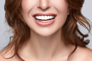 woman smiling with dental crowns