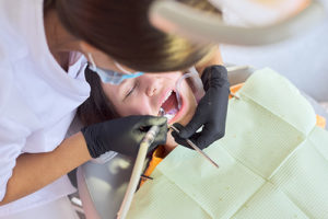 oral surgery being performed