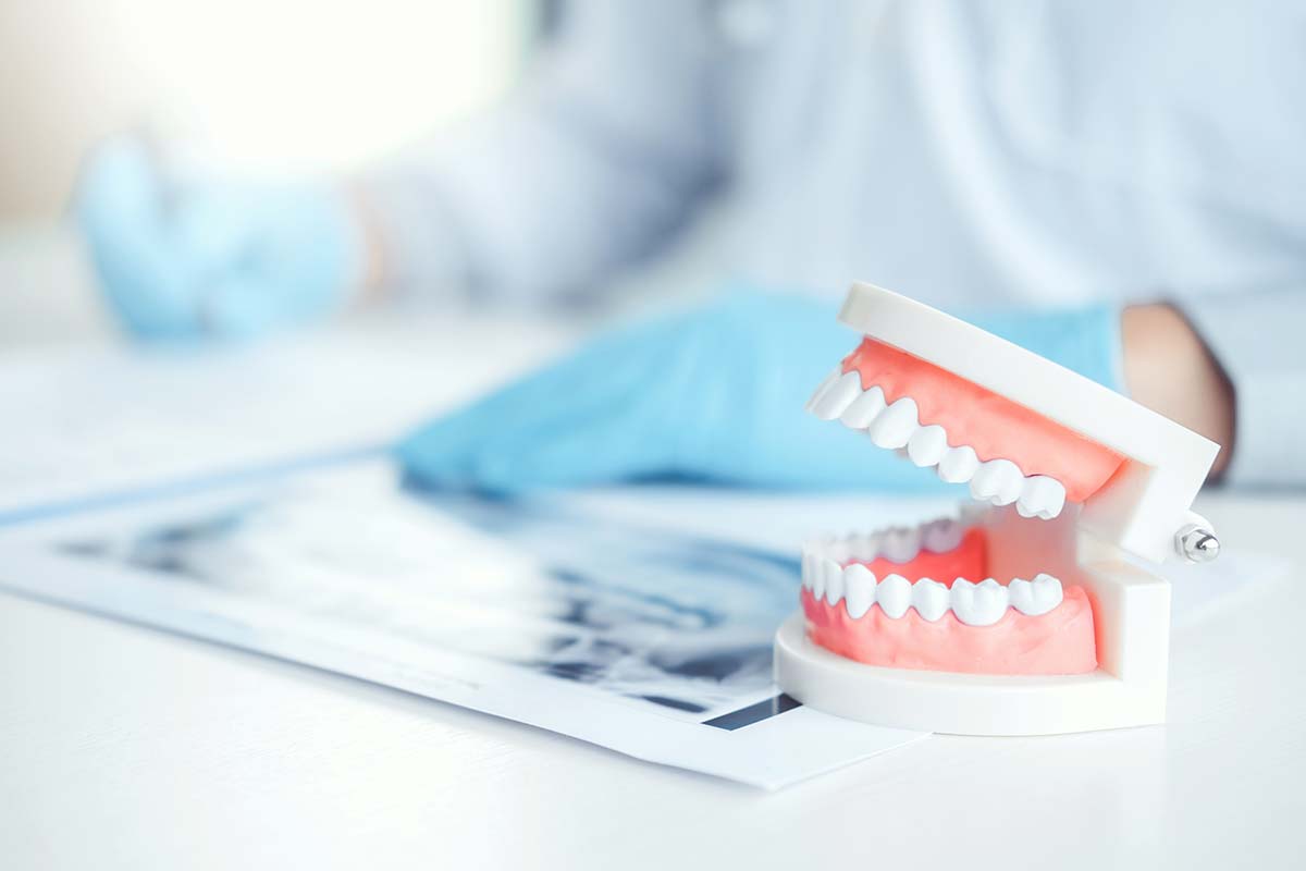 a model of teeth represents a dental emergency