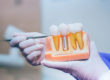 dentist showing example of dental implant